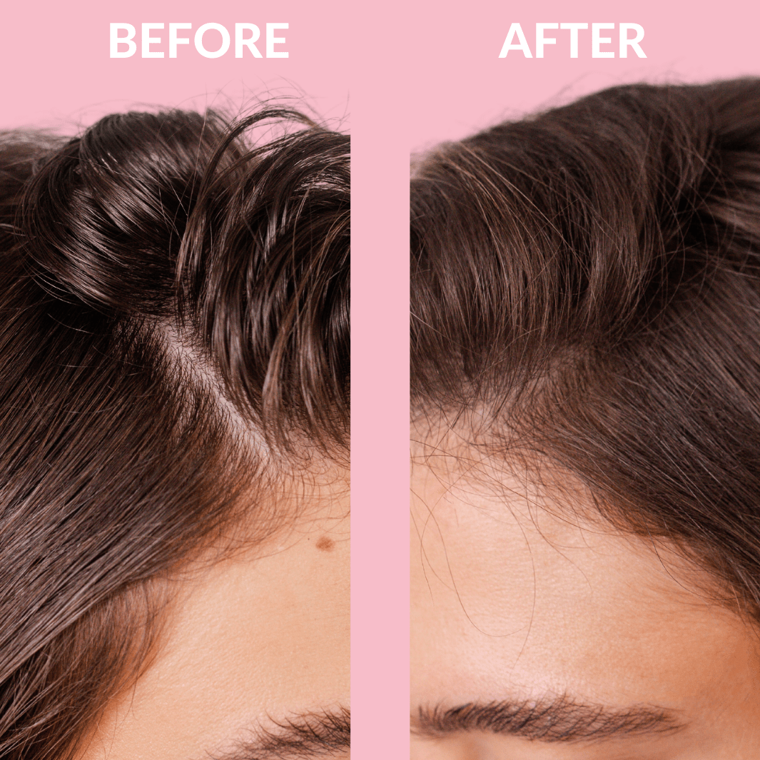 Brushifi Dry Shampoo Kit - Brushifi